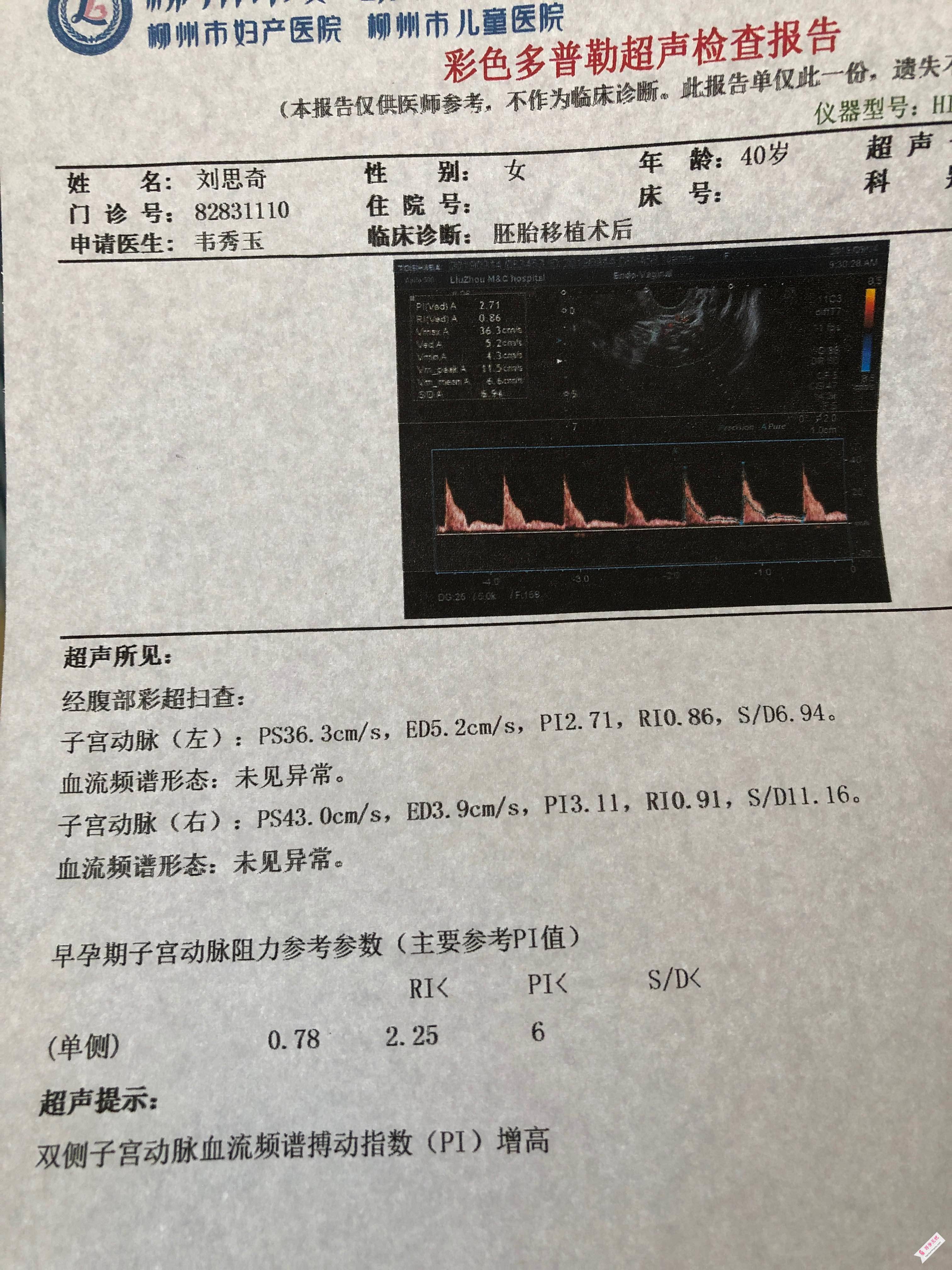 移植22天不见卵黄囊,子宫动脉血流增高