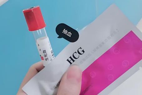 试管婴儿时间表PK：常规长方案与微刺激方案，周期节奏差在哪