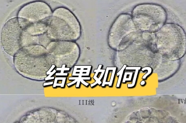 可以通过线下窗口的人工查询养囊结果