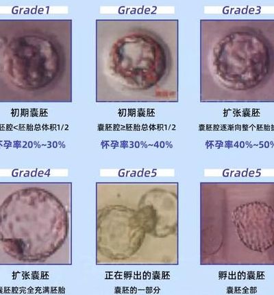 如何去美国做试管婴儿医院？别慌，按这三步走最稳