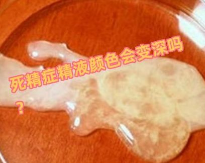 男人死精可以试管婴儿吗？先分清真死精和活而不动。