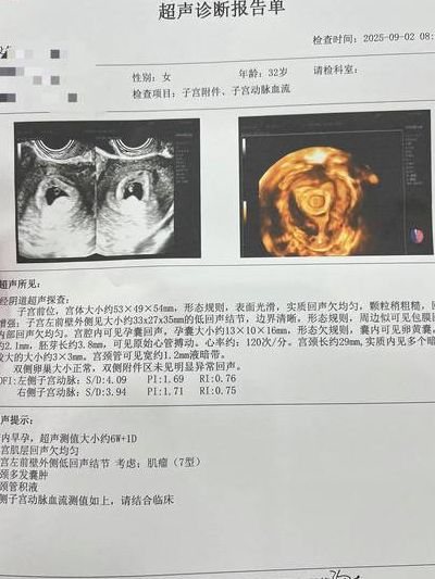 怀孕b超单图片真实背后：试管多少钱？过来人梳理7笔费用明细