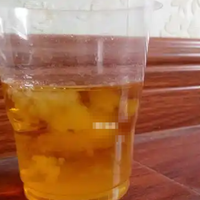 尿液加酒精能测男女？别信这些不靠谱的民间方法！