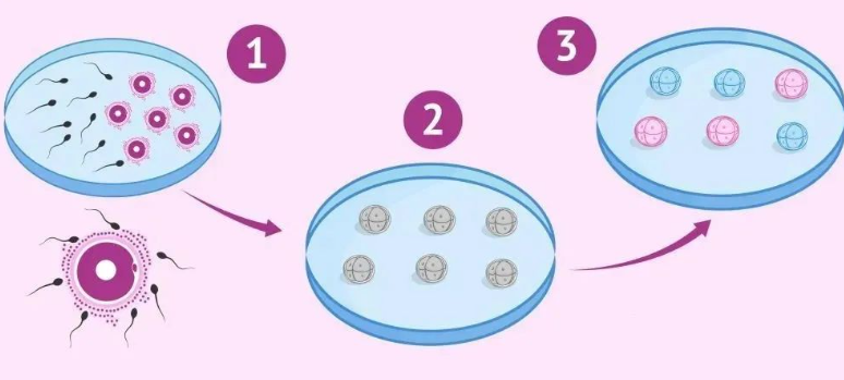 一代试管胚胎是自由结合