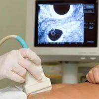 40天孕囊大小几&times;几是女孩?真相揭秘