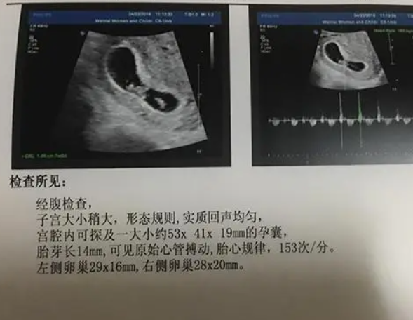 广州做试管婴儿的全部流程广州做试管婴儿要多少钱一次