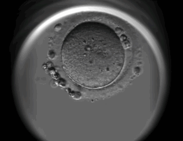 试管婴儿胚胎等级有哪些