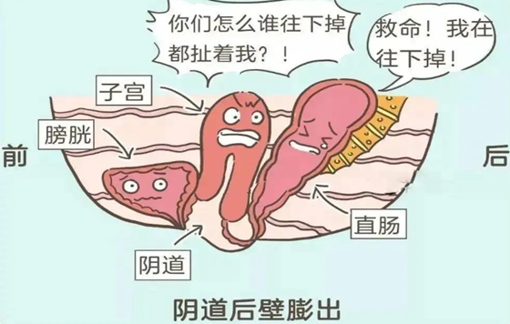 产后阴道壁膨出是什么意思   三种阴道壁膨出治疗方法曝光