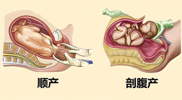 顺产评估需要检查的项目