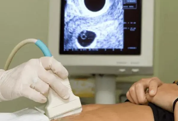 胚胎移植后定期检查