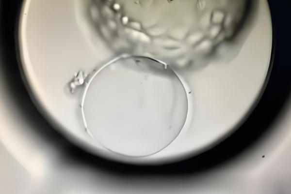 胚胎发育不良生下孩子有可能正常