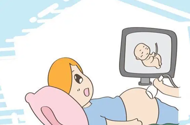 M4YNP[137J6NRHI[5J]72]Y.png