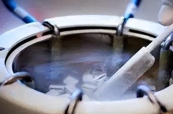 第三代试管胚胎冷冻能避免时间限制