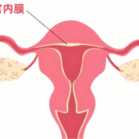 试管子宫内膜薄成功经验 内膜薄做试管的方法