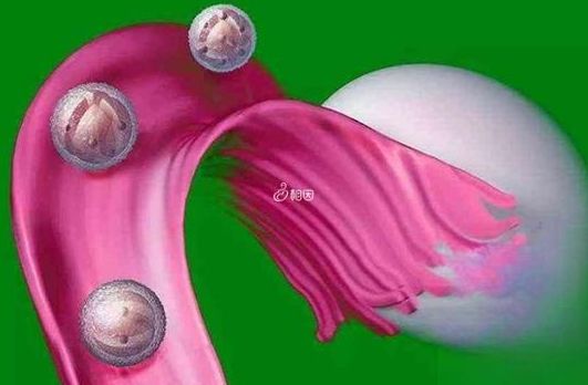 女人打胎后的风水忌讳要懂，做试管多少钱？过来人帮你梳理6笔开销明细