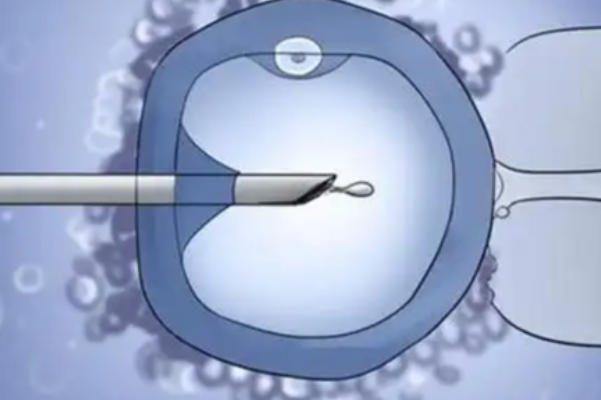 高龄女性可以在美国做试管