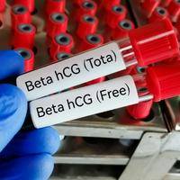 hcg值是多少表示怀孕？大于5只是入场券，翻倍才是通关密码