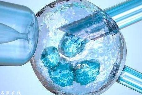 苏州做试管要多少钱费用？过来人帮你梳理每笔开销明细