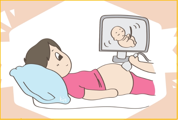 孕期nt检查必不可少