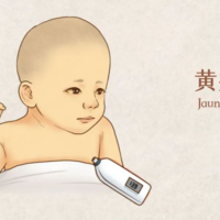 新生婴儿是不是只要手脚不黄就是生理性黄疸不用进行特殊治疗？