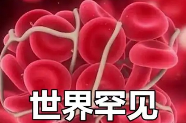 血型与长相有联系