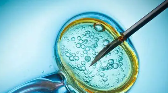 试管请假全攻略：如何顺利请到假？