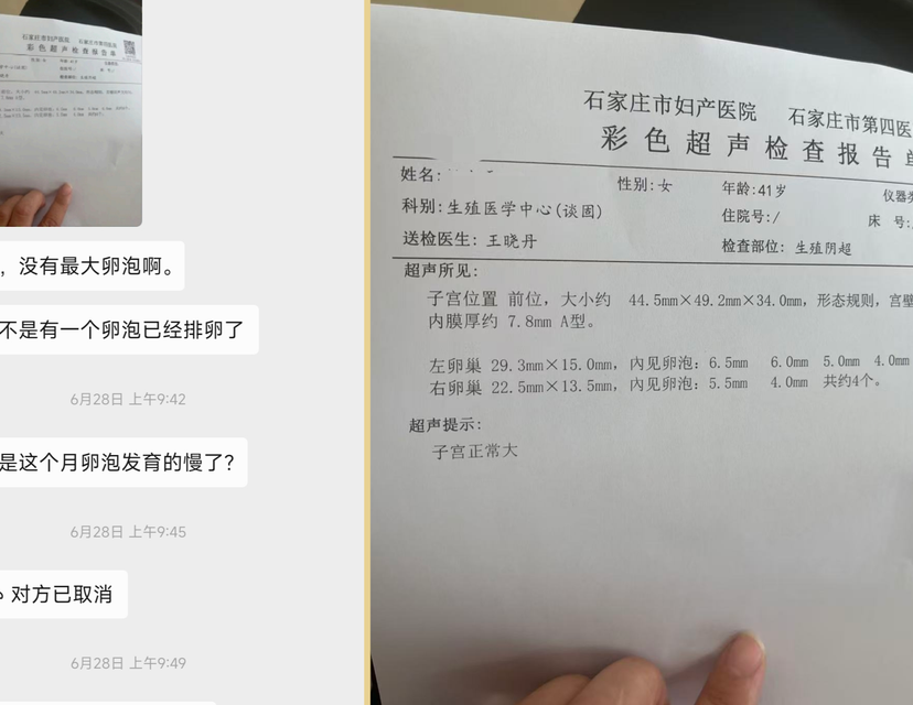 卵巢早衰试管适合什么方案？2026年临床共识给出新答案