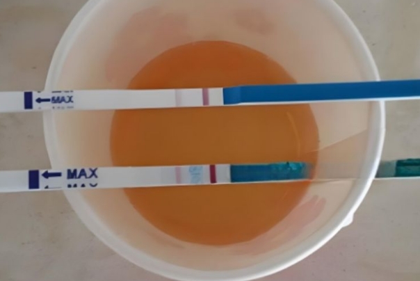 囊胚移植的第4天晨尿测的结果不太准确