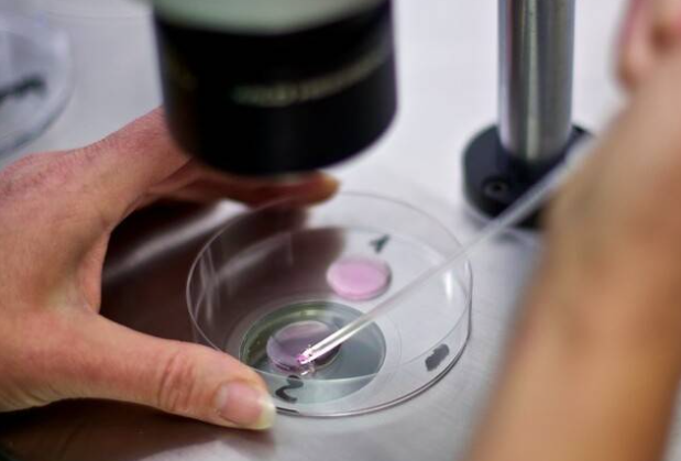 三代试管胚胎筛查处理