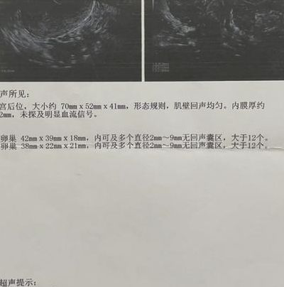 2026年多囊做试管成功率高吗？新颖政策落地，这几点要知道