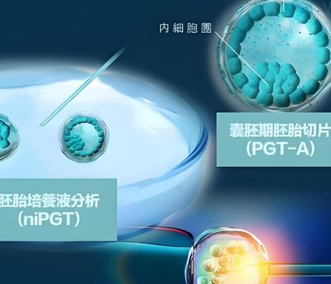 2026年新颖解读：移植后拉肚子会不会把胚胎排出来