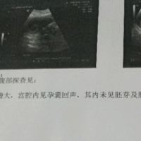 上海供卵代怀包成功上海正规供卵试管婴儿医院排名附试管代怀生子机构一览