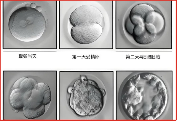 3个都卵泡可以做试管