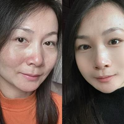 45岁做试管最佳年龄?医生说出真相那刻她愣住了