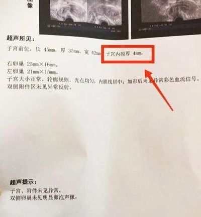 内膜薄了可以试管吗会怀孕吗 先看这3个关键判断