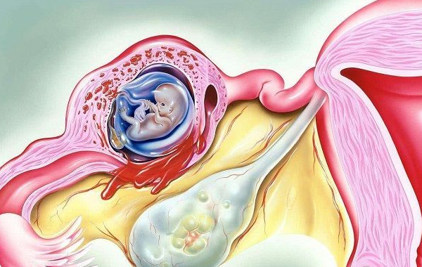 移植胚胎不容易游进输卵管
