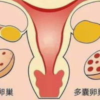 怀孕初期粉色血不腹痛是什么原因