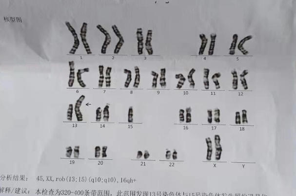夫妻双方做染色体检查费用受项目类型影响