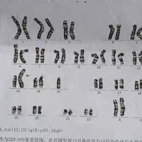 夫妻双方做染色体检查多少钱?这笔账咱们提前算清楚
