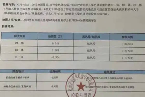 高龄孕妇怎么用无创dna报告看怀男孩女孩最准确的呢？