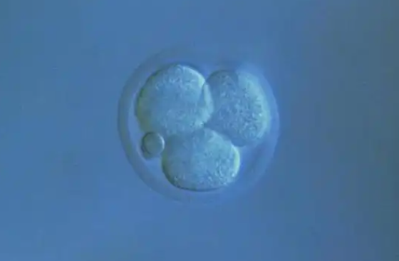 移植后着床可能有出血