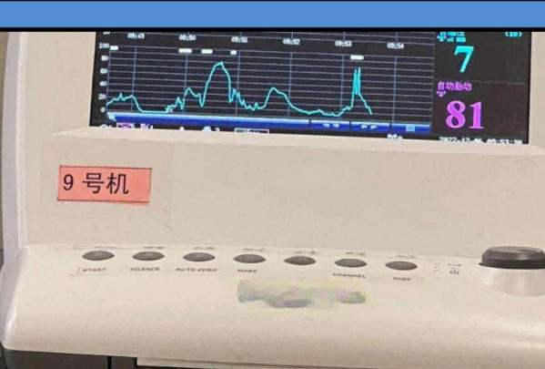 做胎心监护的最佳姿势图片，别再傻傻躺平了