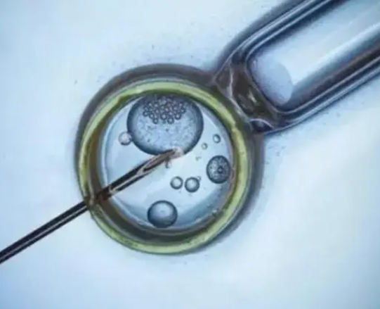 胚胎移植后要抽血验孕