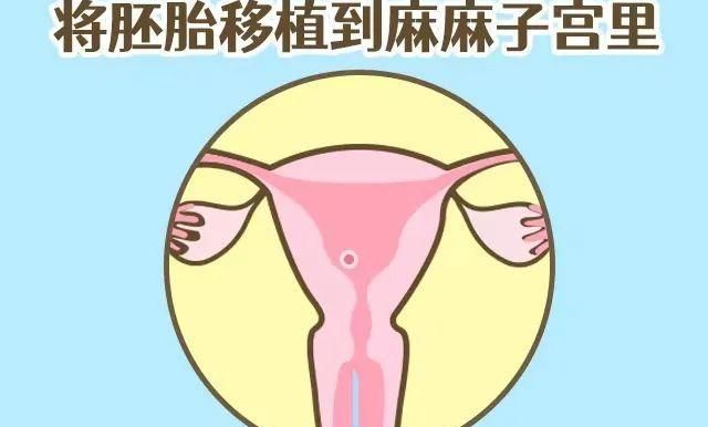 四川哪个医院做试管比较好一点？先看这三步再决定