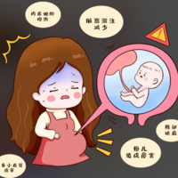 羊水过多会自己降下来吗?B超检查的重点排查