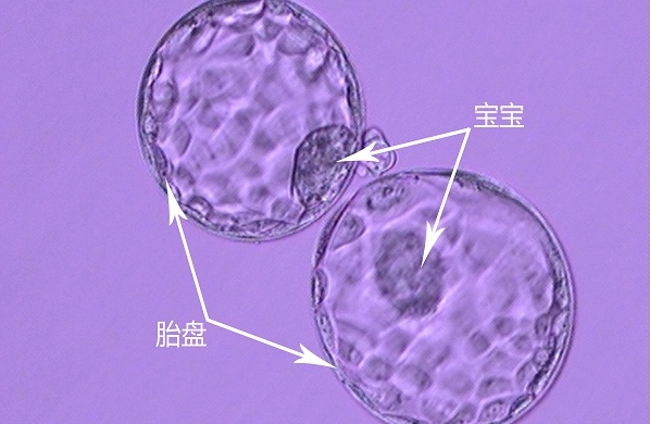 移植失败后的胚胎去处