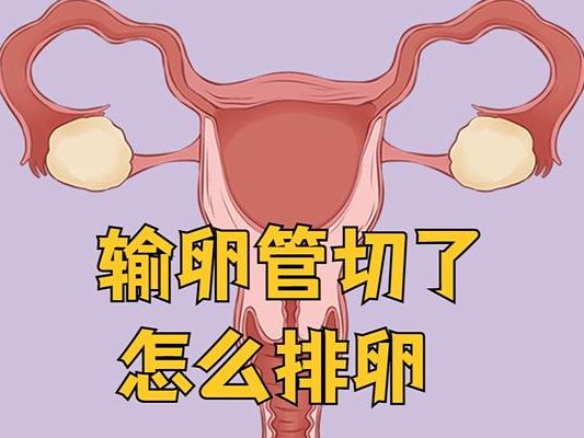 两侧输卵管切除对女人身体有啥影响？5个判断维度帮你选对试管路