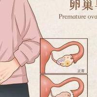 没有卵泡可以做试管吗？先分清暂时没有还是卵巢早衰