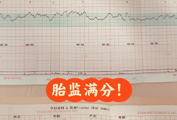 胎心率高低与胎儿性别无关