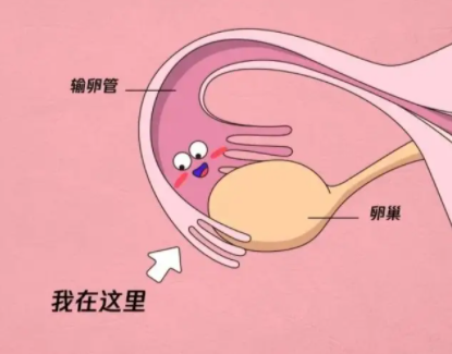 输卵管不孕症做试管怎么样